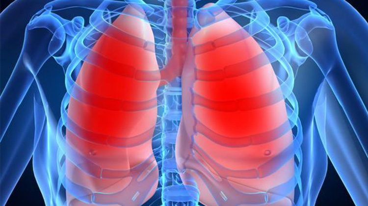 防治肺癌有道　低劑量CT及早揪病灶