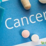 癌症年輕化　預防保健不可忽略什麼？