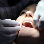 牙醫師警告切勿自行矯正牙齒