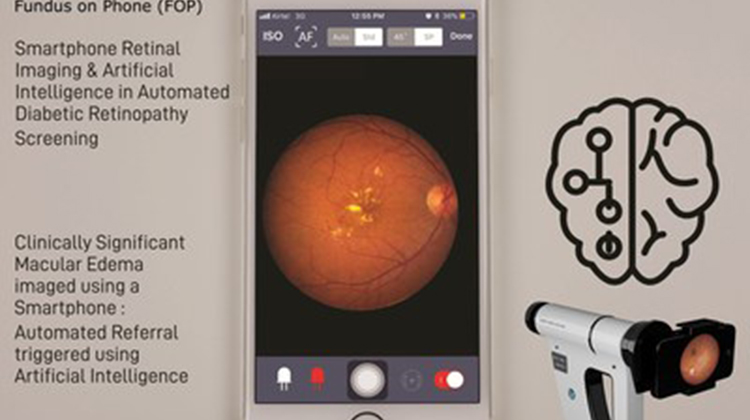 基於智能手機的視網膜成像攜手人工智能，支持對視網膜病變進行高度靈敏的自動化早期檢測