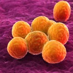細菌和病毒感染有什麼區別？