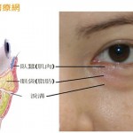 眼袋年齡層降低 　過度使用3C產品成誘因