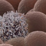 科學家研發出可消滅癌細胞的雷射了？！