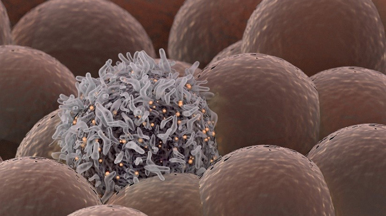 科學家研發出可消滅癌細胞的雷射了？！