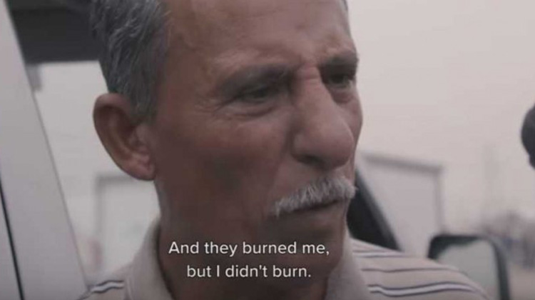 連火都燒不死的奇蹟見證 伊拉克男子被火焚 聖靈保護毫髮無傷生存下來