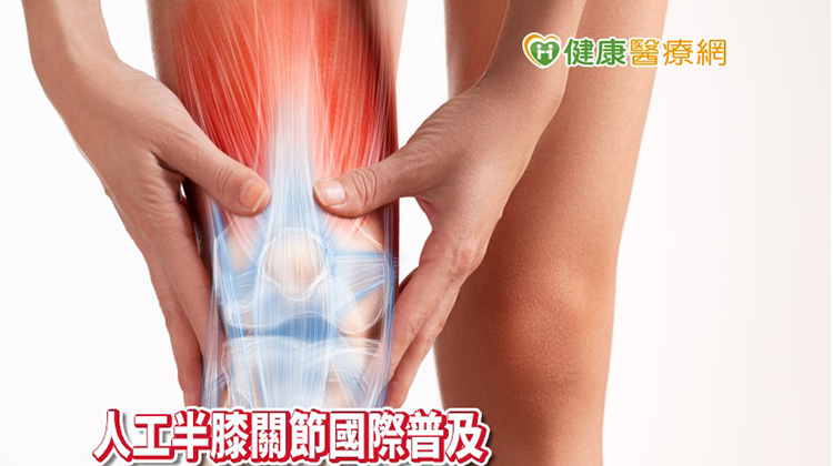 膝蓋痛吃藥、打針都無效 　置換人工半膝關節「彎更多」