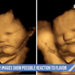 3D超音波影像驚人發現 胎兒在母腹中對味道有反應