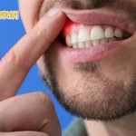 沒有牙痛卻患牙周病？　醫直指「關鍵原因」：當心會遺傳