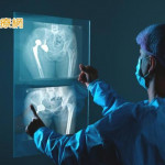 5分鐘解密骨質健康！亞東醫院「AI骨質疏鬆篩檢日」