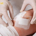 傷口照護學問多　醫師解析8種常見急、慢性傷口照護重點
