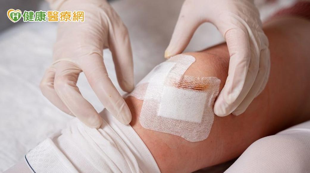 傷口照護學問多　醫師解析8種常見急、慢性傷口照護重點
