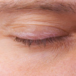 擺脫乾澀，用醫療與保健守護雙眼