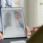 免疫合併療法助攻肺癌治療！醫籲：術前術後搭配成關鍵