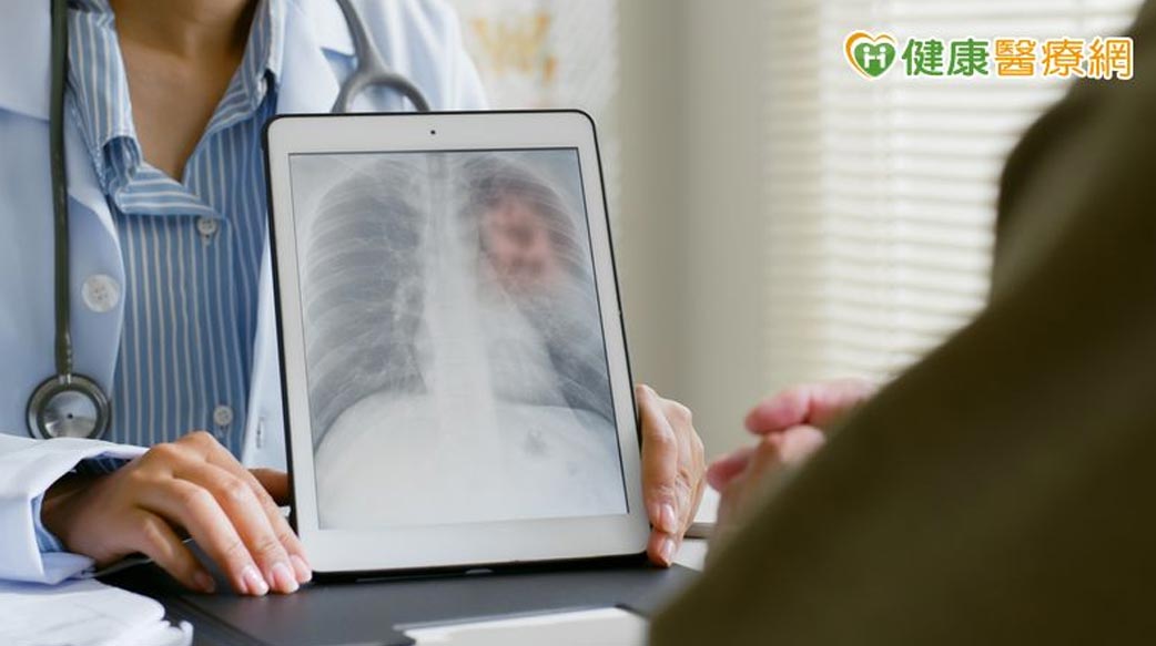 免疫合併療法助攻肺癌治療！醫籲：術前術後搭配成關鍵