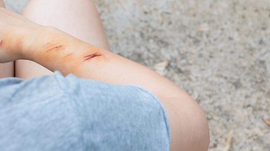 接連街頭暴力事件，考驗政府的安全治理能力