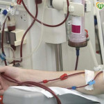 洗血能「洗掉發炎」？醫揭與洗腎差異　臨床定位與風險一次看