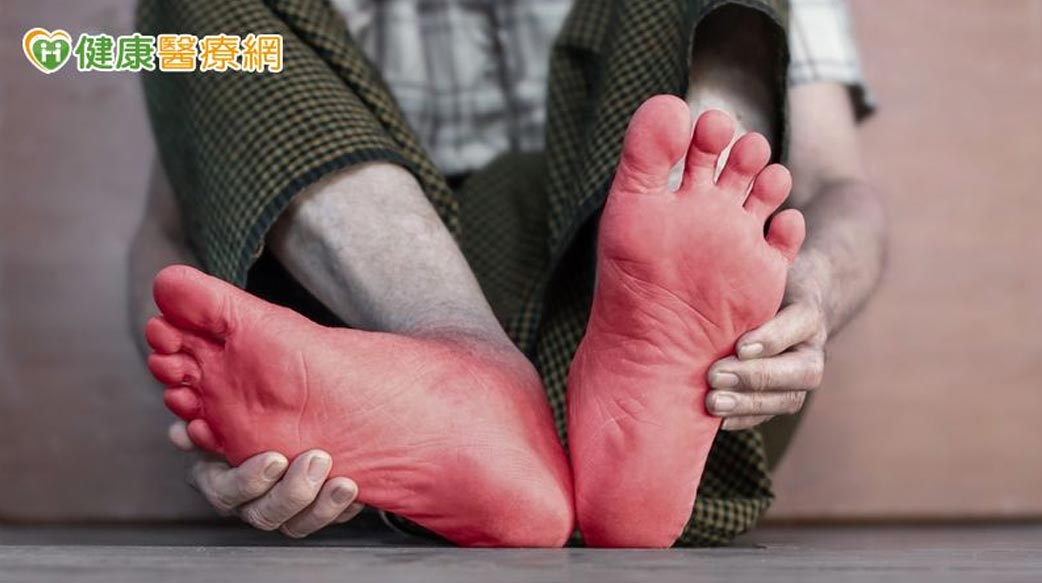 糖尿病神經病變症狀有哪些？中醫談麻木、灼熱感與日常照護