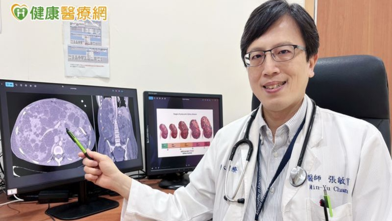 20歲無感10年後竟洗腎？新型口服藥阻多囊腎惡化