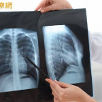 晚期肺癌治療進入組合療法時代　醫：第一線治療策略攸關後續布局