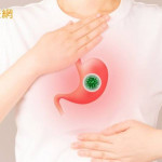沒胃痛也可能感染！幽門螺旋桿菌常無症狀　醫：掌握3步驟防胃癌