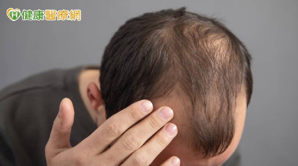 37歲男頭髮愈來愈少以為雄性禿！抽血揪「真正原因」　竟是缺這營養素